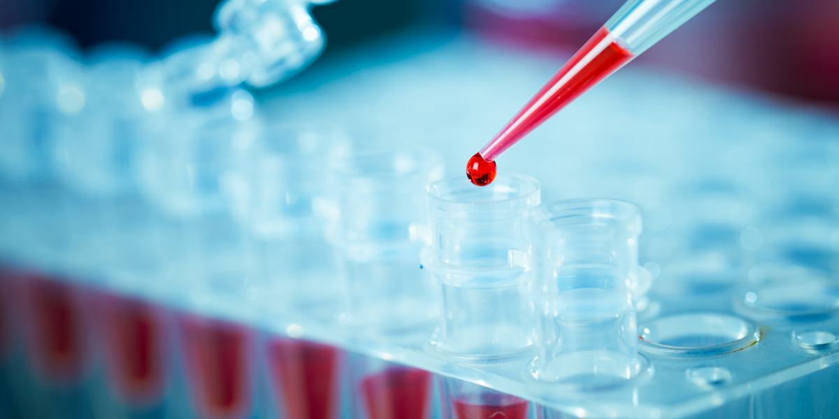 dna-analysis