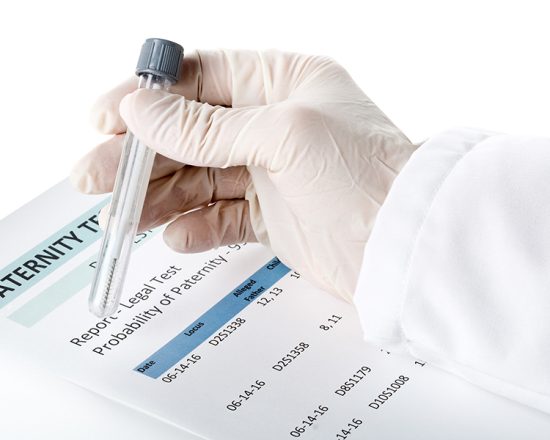 Doctor holding buccal swab in test tube on paternity DNA test result chart form